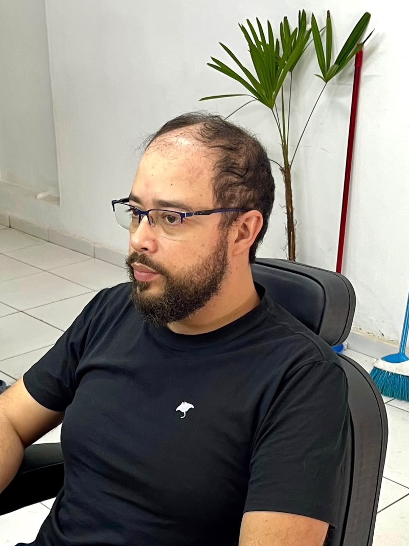 Leir Comunian: antes